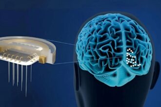 China Approves NEO Brain Implant for Paralysis Recovery