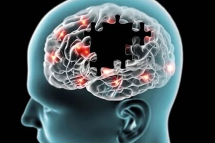 Alzheimer’s Disease: How Early Screening Can Change the Future