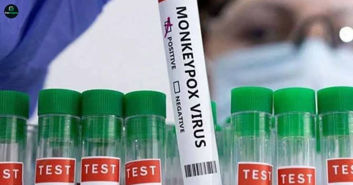 Karachi Confirms Second Monkeypox Case